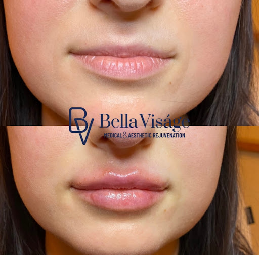 Explore wildland firefighter tattoo ideas, creative tattoo ideas in Lakeland, available at Bella Visge Medical & Aesthetic Rejuvenation