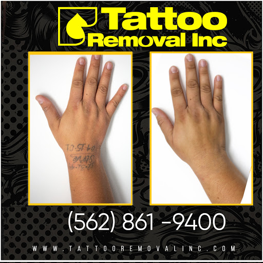 Explore twin tattoo ideas for mom, creative tattoo ideas in South Gate, available at Tattoo Removal Inc