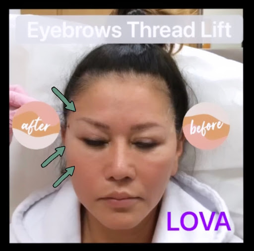 Explore alpha wolf tattoo ideas, creative tattoo ideas in Lake Oswego, available at Lake Oswego Vein and Aesthetic LOVA