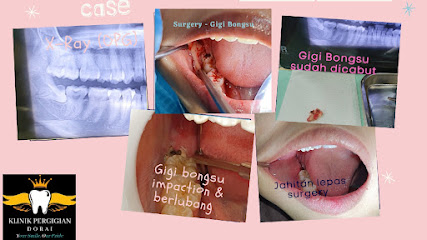 Pakar bedah oral dan maksilofasial
