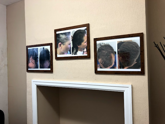 Reading Hair Loss Clinic - Reading