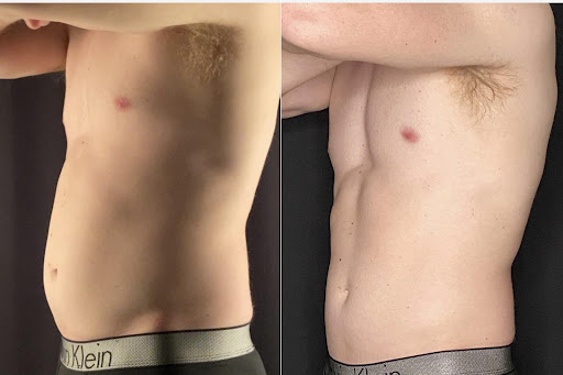 Explore twilight tattoo ideas, creative tattoo ideas in Brookfield, available at Milwaukee Laser & Body Aesthetics