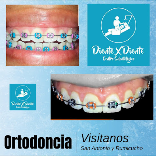 Diente x Diente odontología Rumicucho - Quito
