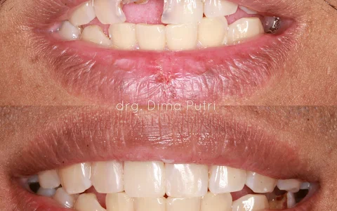 Dentist Dima Putri Saraswati (KITA Dental) image