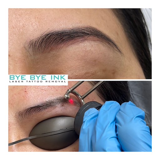 Explore ladies tattoo sleeve ideas, creative tattoo ideas in Middle Village, available at Bye Bye Ink Laser Tattoo Removal