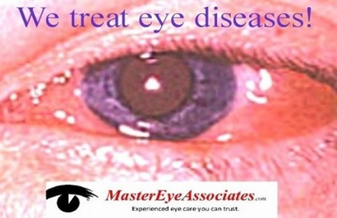 Eye Care Center «Master Eye Associates», reviews and photos, 12700 Hill Country Blvd s, Bee Cave, TX 78738, USA