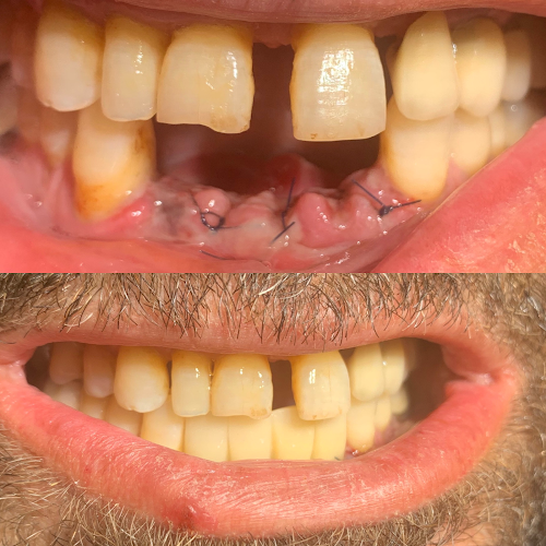 Opinii despre Dentist Crangasi Bucuresti Remis Constantin - Implant Dentar - Fast And Fixed Proteza Fixa în <nil> - Dentist
