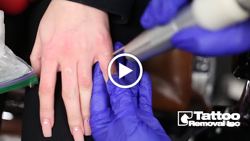 Explore birthday tattoos ideas, creative tattoo ideas in South Gate, available at Tattoo Removal Inc