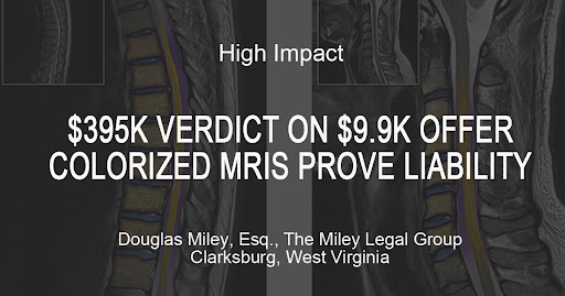 Personal Injury Attorney «The Miley Legal Group», reviews and photos