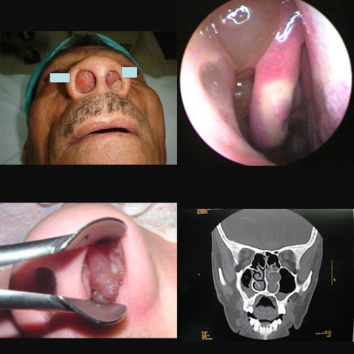 Consultorio Otorrinolaringologico Dr. Dirney Pin - Manta