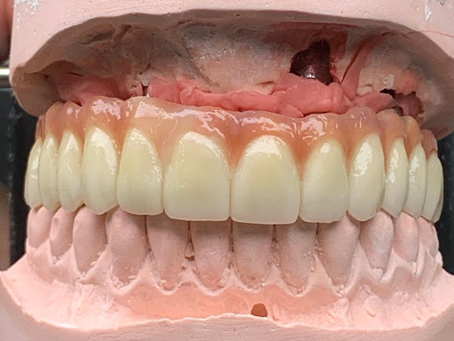 Logo da empresa - Oliveira Neto prótese dentária