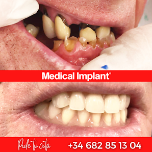 Clínica Dental Medical Implant Tenerife Av. los Abrigos, 21, 38618 Los Abrigos, Santa Cruz de Tenerife, España