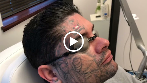 Explore behind the ear tattoo ideas for guys, creative tattoo ideas in Broomfield, available at LaserAll