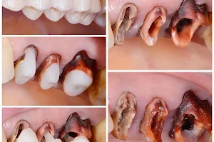 Dr.Mehta's multispeciality dental clinic dental implant and pyorrhea center image