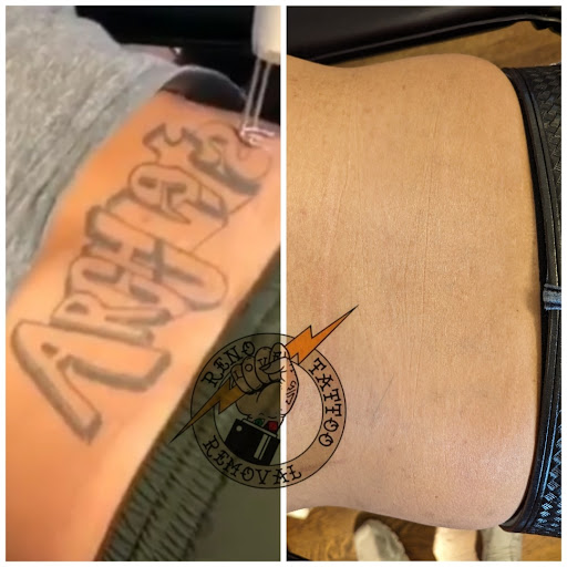 Explore full neck tattoos ideas, creative tattoo ideas in Reno, available at Reno Tattoo Removal