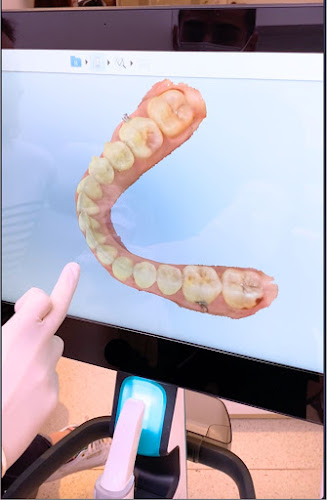 Comentarii opinii despre Hymy Smile Clinic - Traitement Invisalign