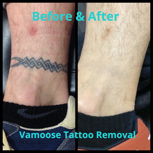 Explore greek words tattoo ideas, creative tattoo ideas in Milwaukee, available at Removery Tattoo Removal & Fading