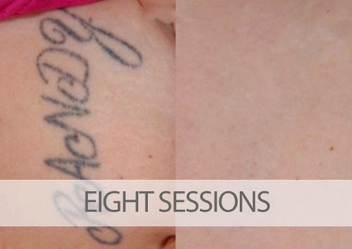 Explore tattoo ideas pin up, creative tattoo ideas in Palm Harbor, available at EradiTatt Tattoo Removal of Palm HarborClearwater