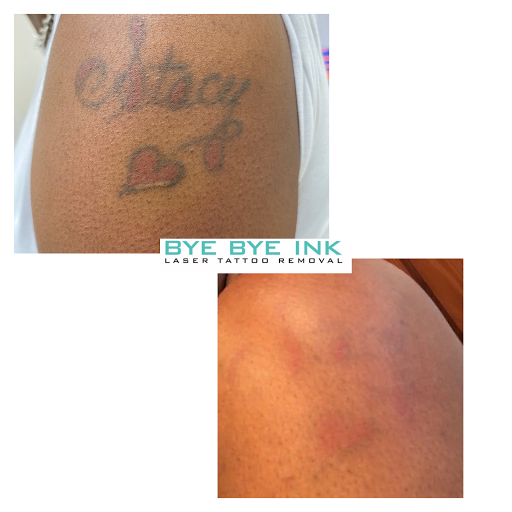 Explore tattoos ideas para hombres, creative tattoo ideas in Middle Village, available at Bye Bye Ink Laser Tattoo Removal