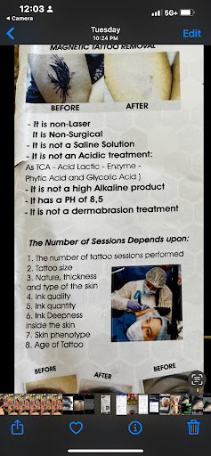 Explore colorado tattoo ideas, creative tattoo ideas in Victorville, available at Goawaytats tattoo removal