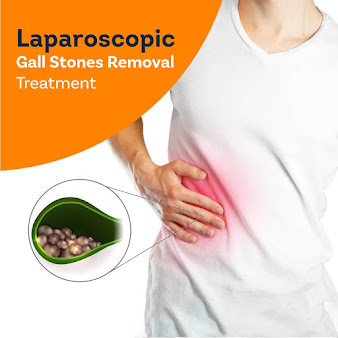 LAPAROSCOPIC SURGERY POINT - New Delhi - LAPAROSCOPIC SURGERY POINT - New Delhi