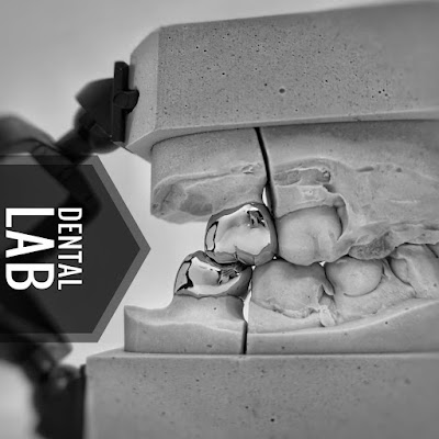 Dental Lab à Joué-lès-Tours
