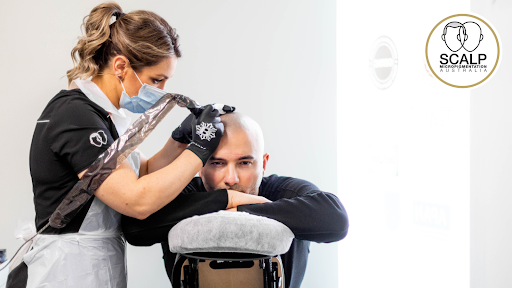 Scalp MicroPigmentation Australia - Adelaide