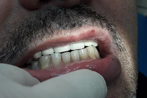 Clínica Dental San Javier image