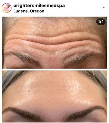 Explore rod wave tattoos ideas, creative tattoo ideas in Eugene, available at Brighter Smiles Med Spa and Laser Center