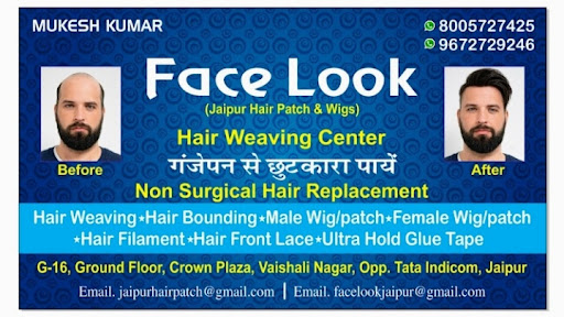 Facelook Hair Patch & Wig center Jaipur