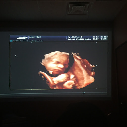Medical Diagnostic Imaging Center «My little baby 4d & boutique», reviews and photos, 8930 TX-121, McKinney, TX 75070, USA