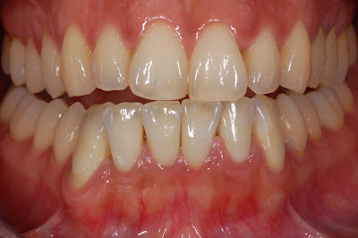 Dr BISSON Bertrand - Dentiste - Metz à Metz