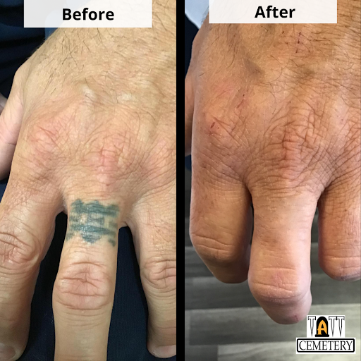 Explore how to think of a tattoo idea, creative tattoo ideas in Fort Myers, available at Laser Tattoo Removal by Tatt Cemetery