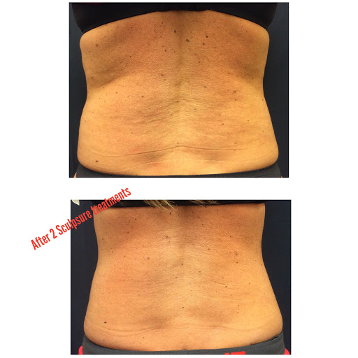 Explore astronomy tattoo ideas, creative tattoo ideas in Lake Oswego, available at Lake Oswego Vein and Aesthetic LOVA