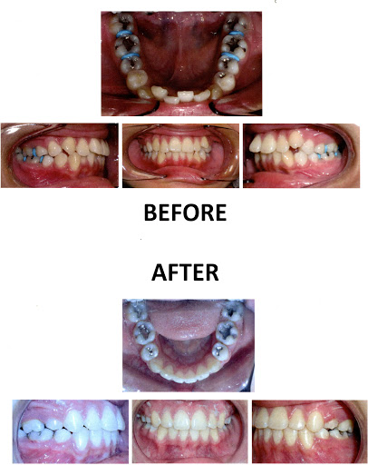 Anaheim Dental & Orthodontics (Braces)