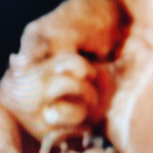 Medical Diagnostic Imaging Center «My little baby 4d & boutique», reviews and photos, 8930 TX-121, McKinney, TX 75070, USA