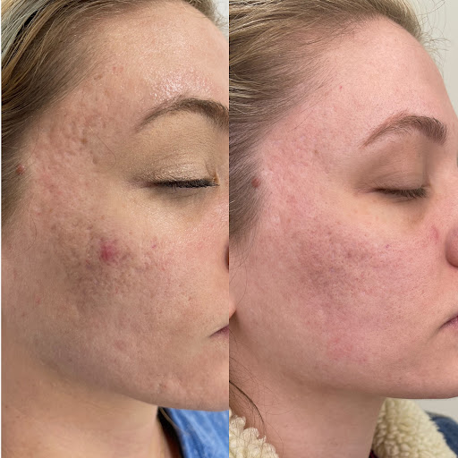 Explore green tattoo ideas, creative tattoo ideas in Owensboro, available at The Skin Lab