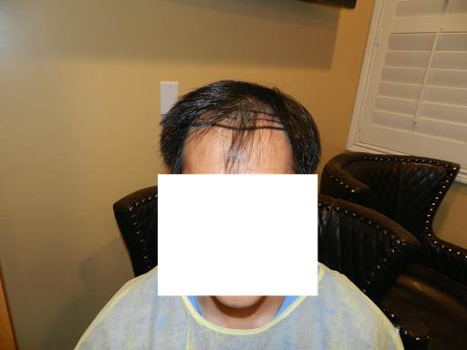 Hair Replacement Service «Medical Hair Transplant & Aesthetics», reviews and photos, 490 Post St #1701, San Francisco, CA 94102, USA