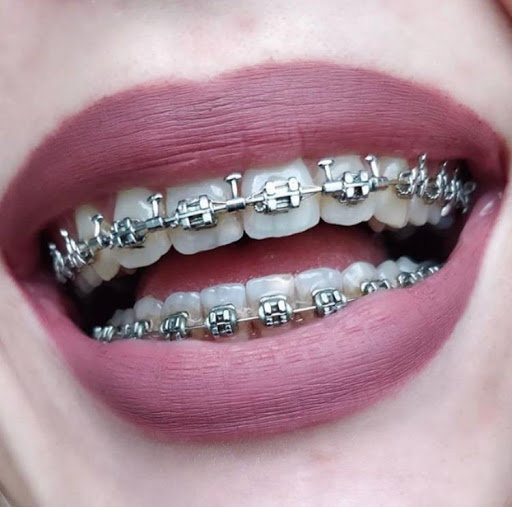 Clínica Dental Gloria Villena en Talará, Granada