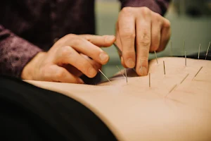 Nanaimo Acupuncture image