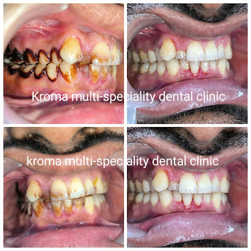 Kroma Multispeciality Dental Clinic - Kroma Multispeciality Dental Clinic