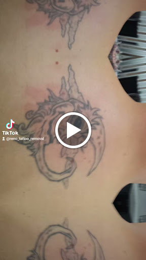 Explore astros tattoo ideas, creative tattoo ideas in Reno, available at Reno Tattoo Removal