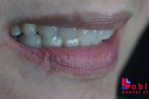 Dobles Dental Clinic | Oral Surgery, Implants, Endodontics and Dental Biomimetic Restoration image