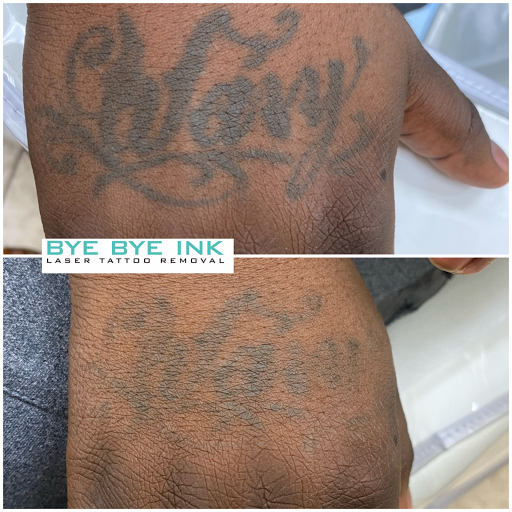 Explore romans 8 18 tattoo ideas, creative tattoo ideas in Middle Village, available at Bye Bye Ink Laser Tattoo Removal