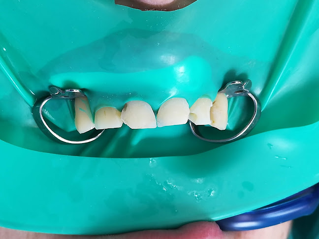 Opiniones de Costa Mar Odontologia en Viña del Mar - Dentista
