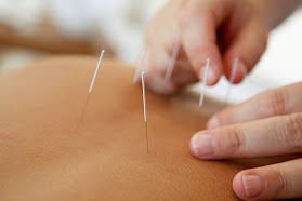 Praxis Raphael Loetscher Akupunktur & Massagen
