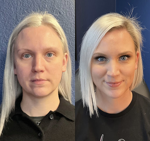 XUNA Aesthetics - Injection Treatments image