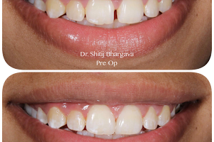 Cure.One Dental Clinic - Smile Designing | Implants | Aligners | RCT - NABH, CGHS, CAPF, ESIC image