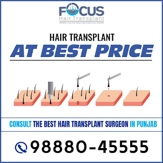 NRI Hair Transplant Centre - NRI Hair Transplant Centre