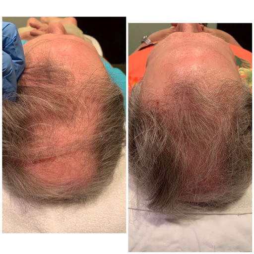 Laser Hair Removal Service «Pure Vanity Spa», reviews and photos, 20511 N Hayden Rd, Scottsdale, AZ 85255, USA